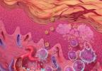 Dupilumab treatment in moderate to severe atopic dermatitis Dupilumab treatment in moderate to severe atopic dermatitis