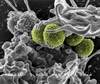 Comparing Vancomycin Treatment Regimens for MRSA Comparing Vancomycin Treatment Regimens for MRSA