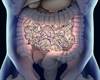 Expert Q&A: Atopic Dermatitis and the Role of Microbial Modulation Expert Q&A: Atopic Dermatitis and the Role of Microbial Modulation