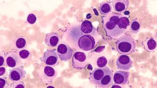 The management of toxicities and re-initiation of medication should be made on a case by case basis, and must take the patient's entire clinical presentation into account. The management of toxicities and re-initiation of medication should be made on a case by case basis, and must take the patient's entire clinical presentation into account.