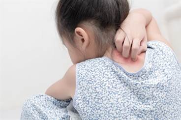 Comorbidity risks increase in children with psoriasis Comorbidity risks increase in children with psoriasis