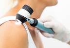 Behavioral counseling for skin cancer prevention: USPSTF updated recommendations Behavioral counseling for skin cancer prevention: USPSTF updated recommendations