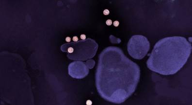 Wart Treatment Response Highly Dependent on HPV Genotype Wart Treatment Response Highly Dependent on HPV Genotype