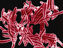 Tuberculosis Assessment More Efficient With Sputum Molecular Testing Tuberculosis Assessment More Efficient With Sputum Molecular Testing