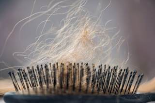 Issues with self-image contribute to poor health-related quality of life in patients with alopecia areata. Issues with self-image contribute to poor health-related quality of life in patients with alopecia areata.