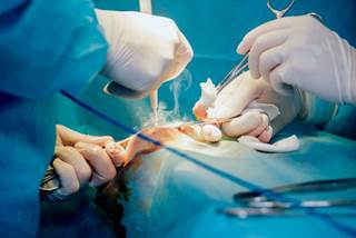 The number of online reviews for breast augmentation grew at an average rate of 42.6 percent per year between 2011 and 2016. The number of online reviews for breast augmentation grew at an average rate of 42.6 percent per year between 2011 and 2016.