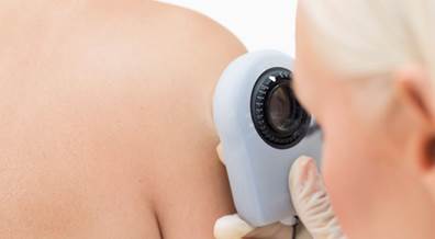 Australian Researchers Develop First Blood Test for Melanoma Australian Researchers Develop First Blood Test for Melanoma