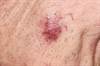 The Association Between Skin Diseases and Metabolic Syndrome The Association Between Skin Diseases and Metabolic Syndrome