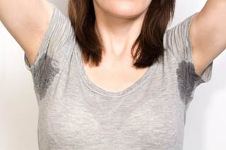 Hyperhidrosis was more prevalent among both men and women who were obese compared with those of normal weight.