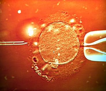 Live Birth Rates Unaffected by Endometrial Scratching During In Vitro Fertilization Live Birth Rates Unaffected by Endometrial Scratching During In Vitro Fertilization