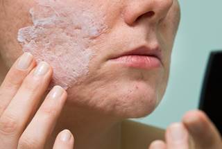 Tretinoin 0.05 percent lotion provides statistically significant improvement in patients with moderate-to-severe acne, compared to placebo. Tretinoin 0.05 percent lotion provides statistically significant improvement in patients with moderate-to-severe acne, compared to placebo.