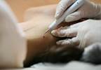Non-Physician Practitioners Expanding Scope of Practice in Dermatology Non-Physician Practitioners Expanding Scope of Practice in Dermatology