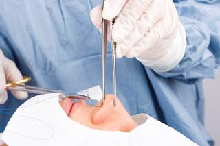 Patients with nasal airway obstruction have health utility values below the mean Australian norm, with improvement noted after open septorhinoplasty. Patients with nasal airway obstruction have health utility values below the mean Australian norm, with improvement noted after open septorhinoplasty.