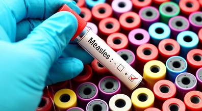 Washington State Declares Health Emergency as Measles Spreads Washington State Declares Health Emergency as Measles Spreads