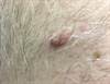 Derm Dx: Hyperkeratotic Plaque on the Chest Derm Dx: Hyperkeratotic Plaque on the Chest